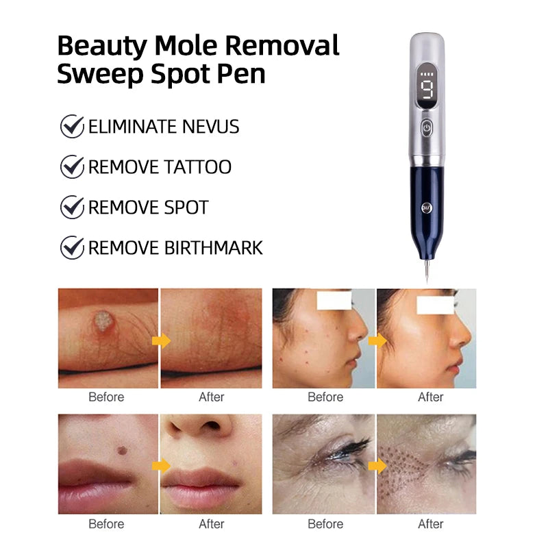 Pluma de Plasma láser para lunares, manchas oscuras, pecas, Nevus, verrugas, etiqueta de piel, espinillas, eliminación de tatuajes, cuidado de la piel, máquina de belleza, papiloma