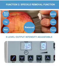 Máquina Facial Ultrasónica 3 en 1, Eliminación de Tatuajes, Verrugas, Lunares y Pecas, Micro Plasma, Pluma de Eliminación de Pecas